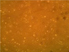 人前列腺微血管內(nèi)皮細(xì)胞(HPMEC)