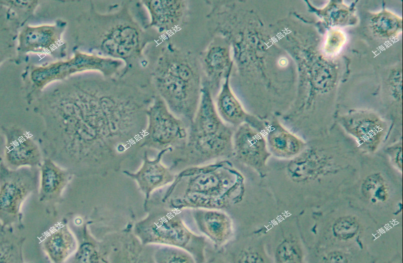 NCI-H661人大細(xì)胞肺癌細(xì)胞