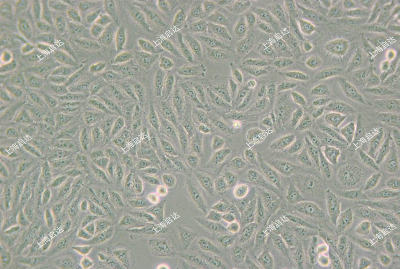 TPC-1 人甲狀腺乳頭狀癌細(xì)胞株