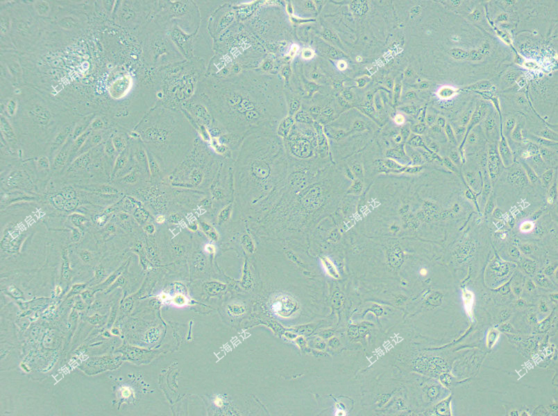 SW626人卵巢腺癌細(xì)胞