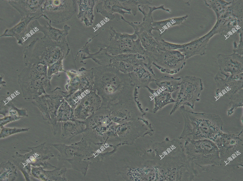 HS 578T人乳腺癌細(xì)胞