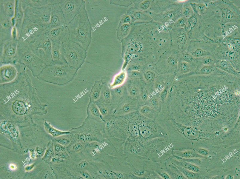 SW626人卵巢腺癌細(xì)胞