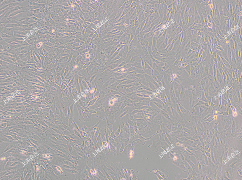 SW 982 [SW-982, SW982]人滑膜肉瘤細胞