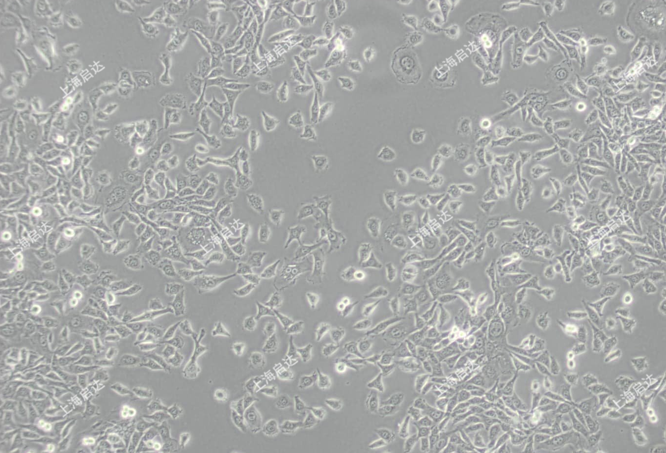 MDA-MB-415人乳腺腺癌細(xì)胞