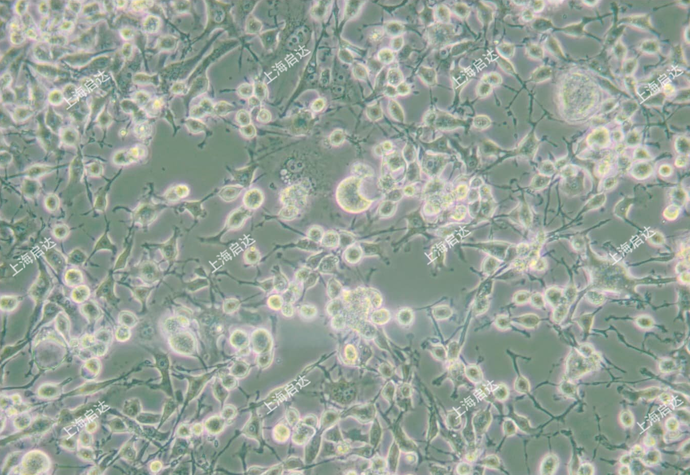 MDA-MB-436人乳腺腺癌細(xì)胞