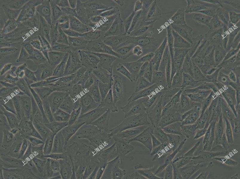 Saos-2人骨肉瘤細(xì)胞