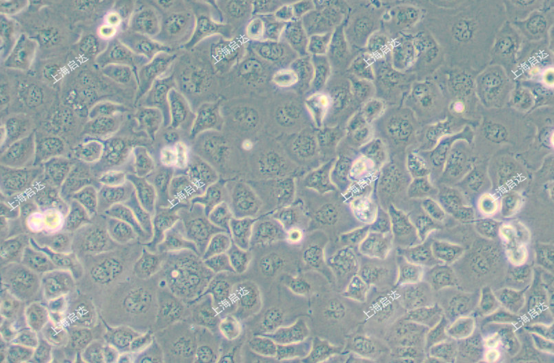 NCI-H661人大細(xì)胞肺癌細(xì)胞