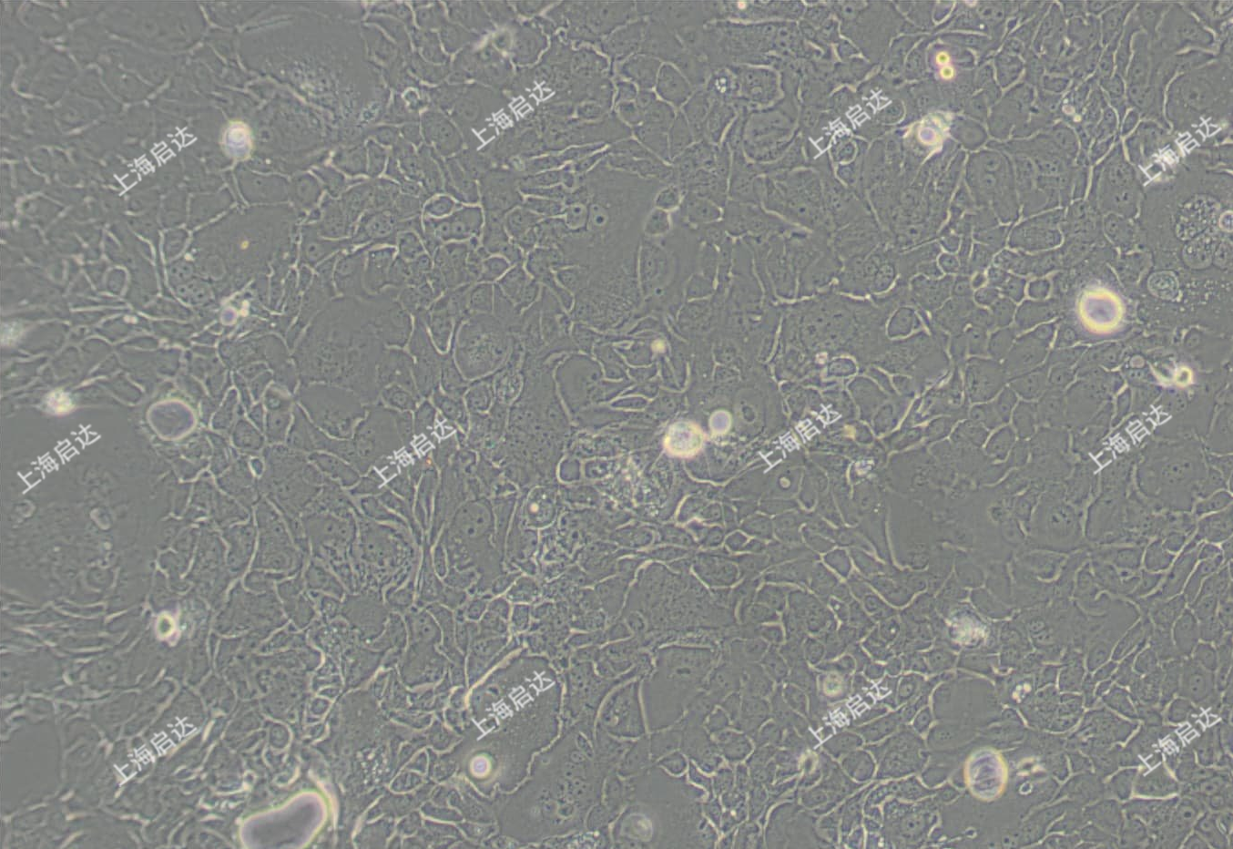 SW 1990 [SW-1990, SW1990]人胰腺癌細(xì)胞