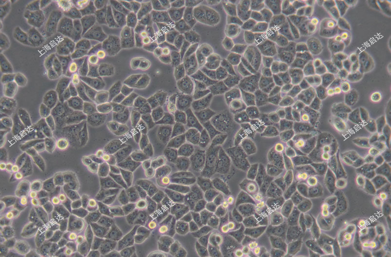 MDA-MB-468人乳腺癌細胞
