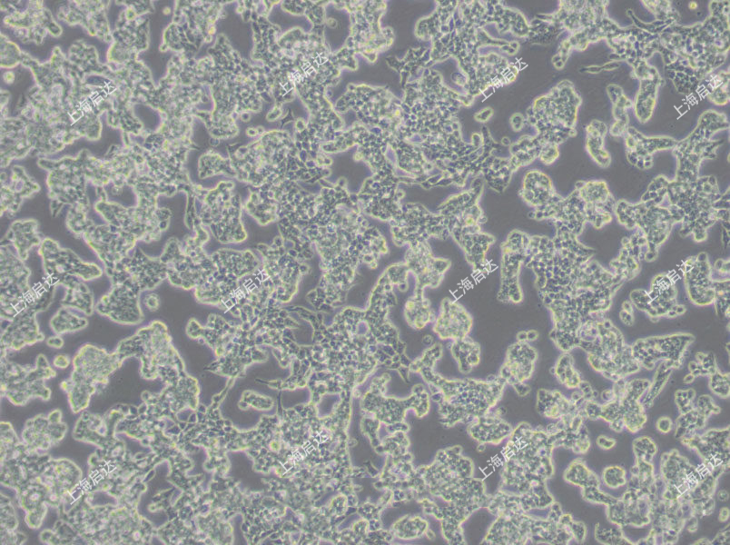 RL95-2人子宮內(nèi)膜癌細(xì)胞