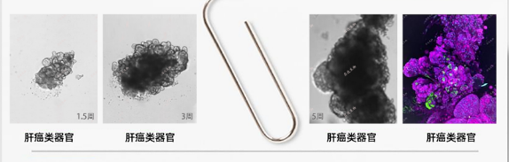 值得關注，類器官操作的Protocol