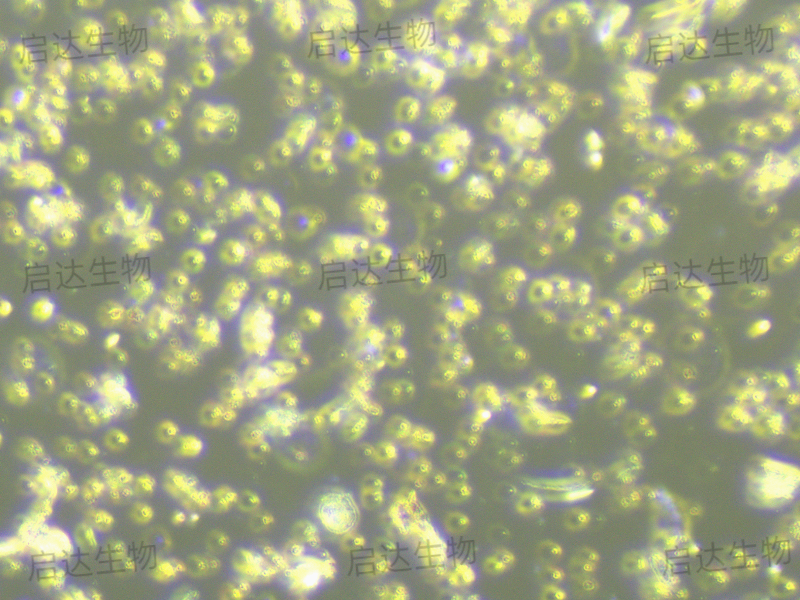 T2(174 x CEM.T2)人淋巴母細胞