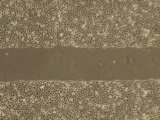 掌握這6個(gè)細(xì)節(jié)，細(xì)胞劃痕實(shí)驗(yàn)一次成功！